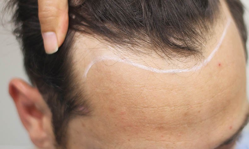 Delight clinic gurgaon