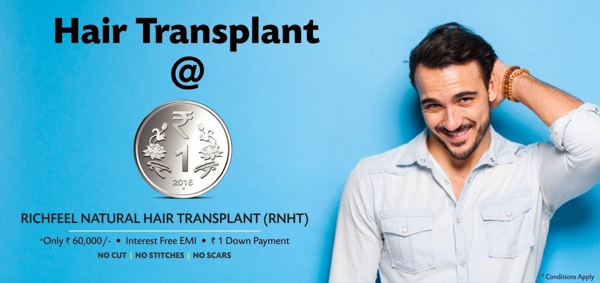 richfeel hair transplant gurgaon